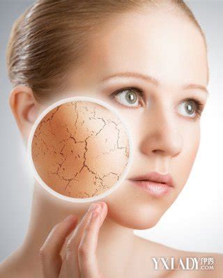 【图】什么是敏感皮肤 治疗预防方法一次性全部掌握(2)_敏感皮肤_伊秀美容网|yxlady.com