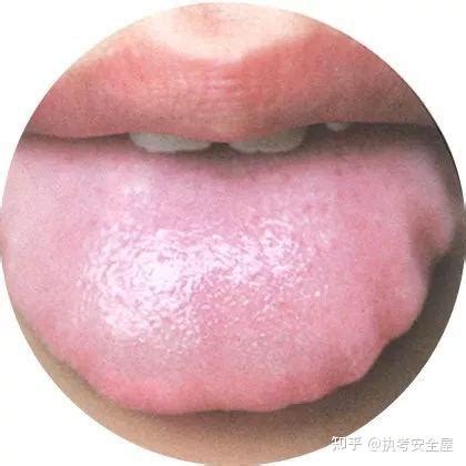 为什么中医要看你的舌头？ 舌头原来是人体健康的“放大镜” - 厦门立和中医