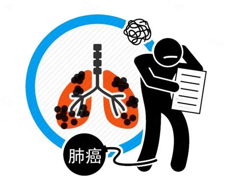 肺癌认识误区|肺癌|治疗|化疗|手术|-健康界