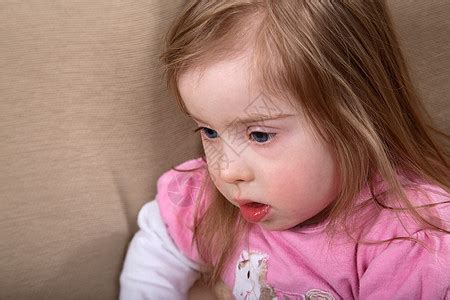 唐氏综合症女孩残障童年白色人士眼睛儿童精神蓝色疾病孩子高清图片下载-正版图片320000124-摄图网