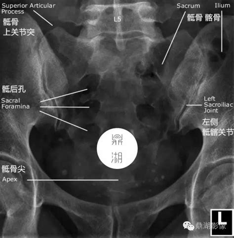 骶尾椎解剖图图片