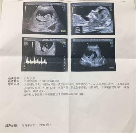 13周已生男宝的nt单子 有3个亮点就暗示生男孩_试管婴儿百科-试管邦
