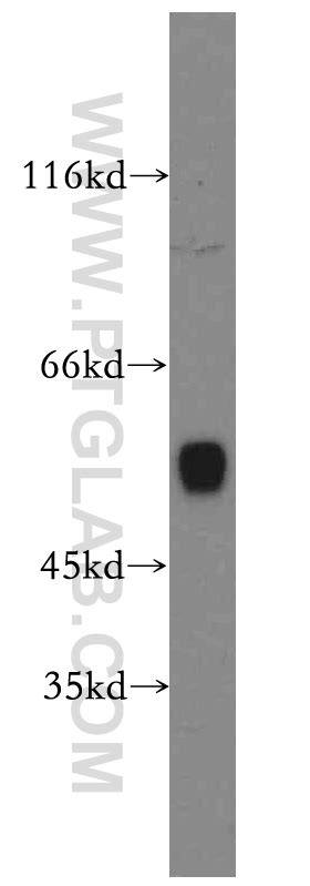 CYP1A2-Specific Antibody 19936-1-AP | Proteintech