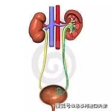 输尿管图片