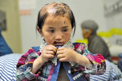 中国孩子挨揍时，法律为何没能给予足够的保护？_今日话题_腾讯网