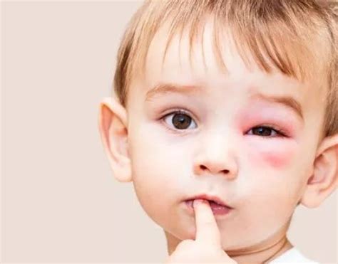 新生儿如何预防宝宝被蚊虫叮咬 孩子被蚊子咬了怎么办 _八宝网