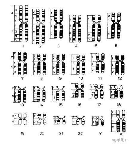 染色体核型分析G显带，浅带和深带哪个更重要?_疾病相关_检验视界_检验视界网