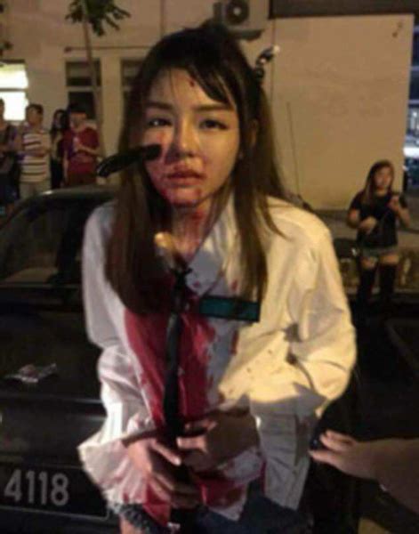 凶残！马来西亚女子反抗抢劫右脸被劫匪插进一把刀_博览_环球网