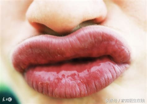 嘴唇黑怎么回事男性（唇色为黑色——大肠有问题 | 唇色与健康的关系） | 说明书网