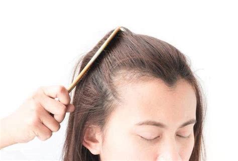 头发稀疏怎么恢复（如何留住日渐稀少的头发？） | 说明书网