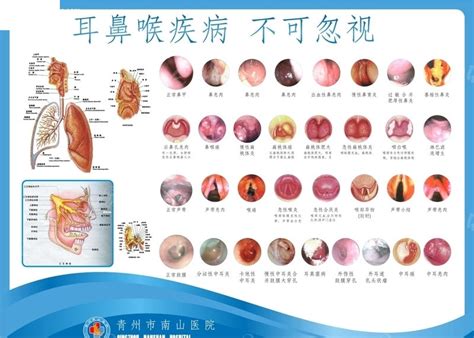 耳鼻喉科解剖图挂板CDR素材免费下载_红动中国