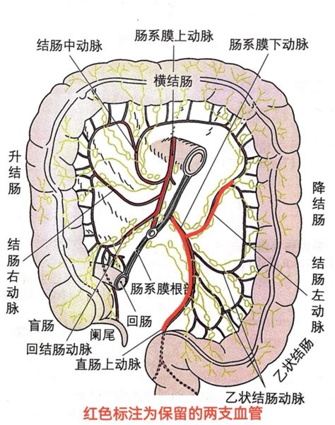 乙状结肠位置图图片