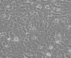 4T1细胞-小鼠乳腺癌细胞 -VectorHub