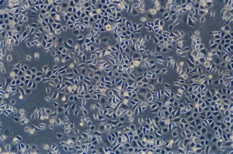 AGS细胞ATCC CRL-1739细胞 人胃腺癌细胞株购买价格、培养基、培养条件、细胞图片、特征等基本信息_生物风