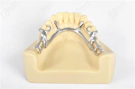 铸造支架义齿设计图谱收集（一）-李望松的博客-KQ88口腔博客