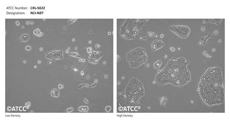 NCI-N87细胞ATCC CRL-5822细胞 NCIN87人胃癌细胞株购买价格、培养基、培养条件、细胞图片、特征等基本信息_生物风