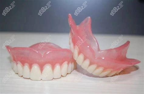 全口活动义齿多少钱一副?测评舒服的满口活动假牙价格6q-3w - 口腔资讯 - 牙齿矫正网