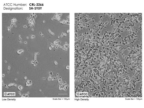 SH-sy5y细胞（人神经母细胞瘤细胞）培养注意事项-上海传秋生物科技有限公司