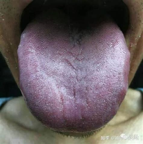 中医看舌头都在看什么？九种体质+珍贵的舌诊图。