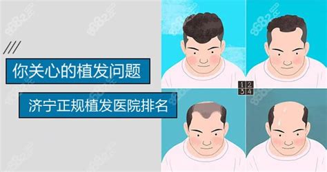 中国十大植发医院排名榜-爱丽帮