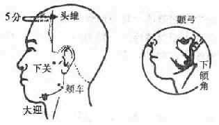 头维的准确位置图图片