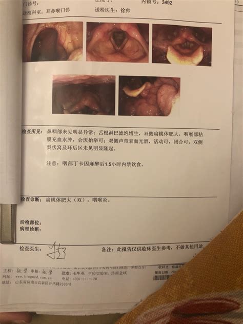 喉咙正常图片