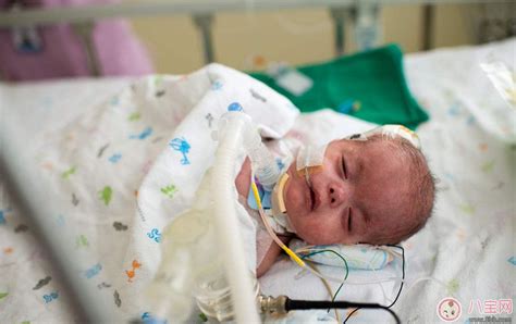 新生儿猝死综合症是什么 怎么避免孩子因为睡觉不当而死亡 _八宝网