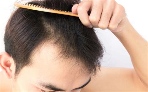 为什么人体头发比其他部位的毛发更多 人类为什么要褪去长毛 _八宝网