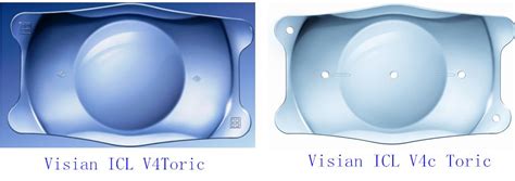 眼睛icl晶体植入手术优势：1800度内近视做icl晶体植入创伤小,近视眼矫正-8682整形网