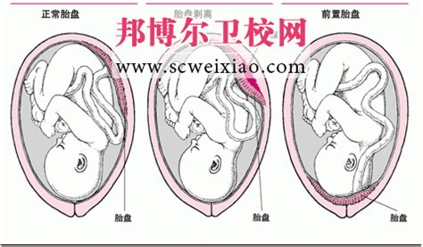 胎儿附属物的形成及作用_邦博尔卫校网