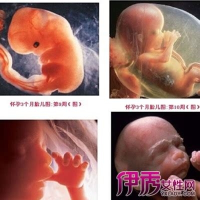 怀孕八个月胎儿彩超 四维彩超是什么 - 三九养生堂