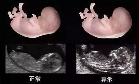怀孕三个月是多少周，胎儿3个月、6个月、10个月的时候分别有多大 - 科猫网