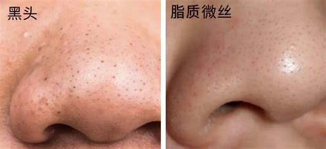 头像～女黑头图片