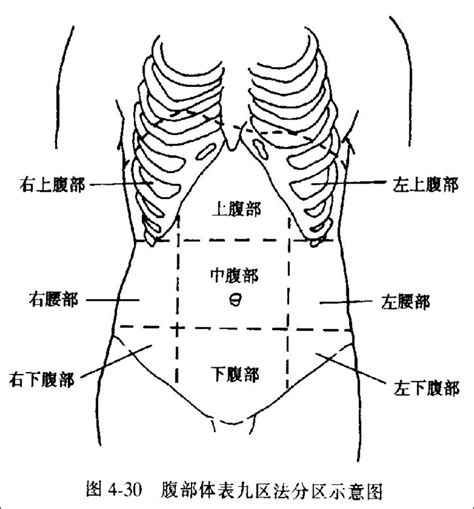 腹部分区：判断腹痛原因