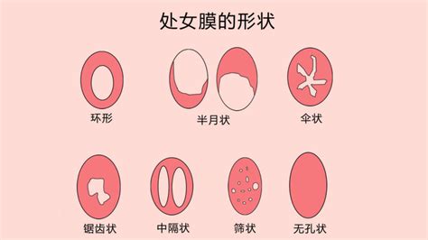 处女逼图片