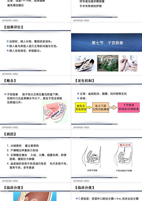 会阴图图片