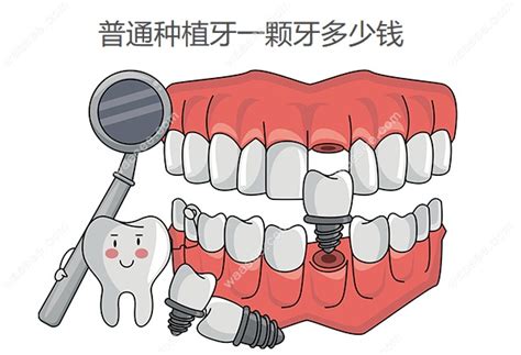 种一颗牙，你要承受多少“创伤”？ __凤凰网
