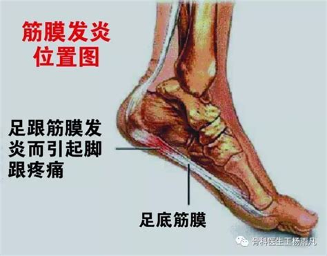 脚侧面疼是怎么回事怎么治（脚的外侧出现疼痛，一般是这几个原因造成的，有轻也有重） | 说明书网