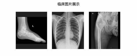 蓝宝石5700xt全型号图