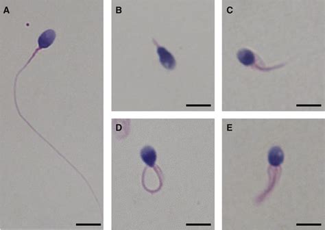 张锋教授等鉴定了新的精子畸形致病基因DNAH8 - 生物通