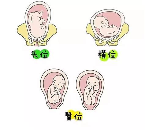 胎儿横位 - 快懂百科