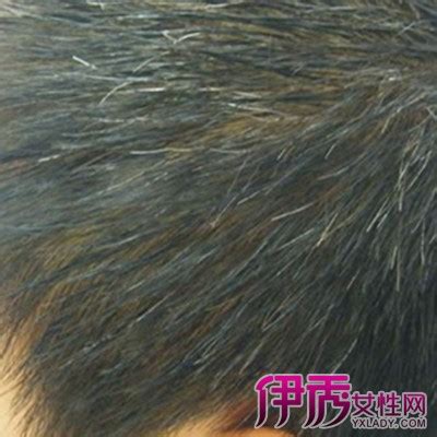 【白头发怎么治】【图】白头发怎么治疗 六大方法还你乌黑发色(2)_伊秀健康|yxlady.com