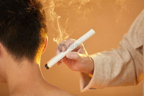 艾灸高清图片