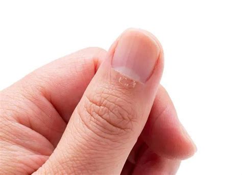 【脚指甲变白是怎么回事】【图】脚指甲变白是怎么回事 揭晓指甲泛白的主要病因(2)_伊秀健康|yxlady.com