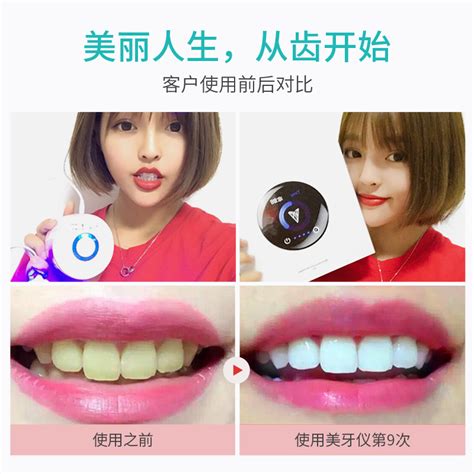 苏琪国际艾丝拉冷光美牙仪图片