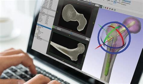 医学影像三维重建软件如何助力定制化3D打印植入物设计？ - 3D科学谷