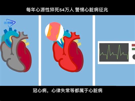 医生教你如何远离心脏性猝死-微专栏-第145期-中国数字科技馆