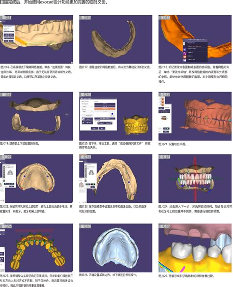 5月20日 德伦3D导板数字化无牙颌种牙直播_广州德伦口腔