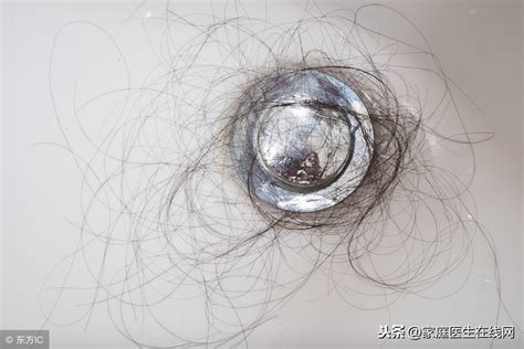 【图】夏天洗头掉好多头发怎么办 7种方法让你拥有完整头发_伊秀美容网|yxlady.com