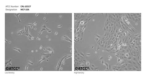 MCF 10A细胞ATCC CRL-10317细胞 MCF10A人正常乳腺上皮细胞株购买价格、培养基、培养条件、细胞图片、特征等基本信息_生物风